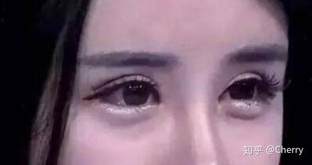 网红双眼皮  第3张